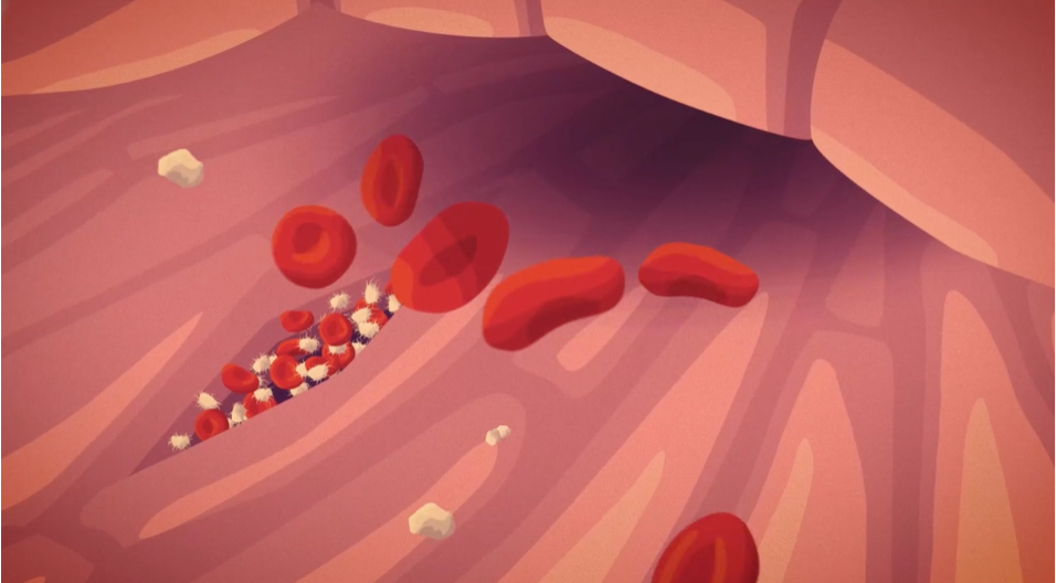 animated-video